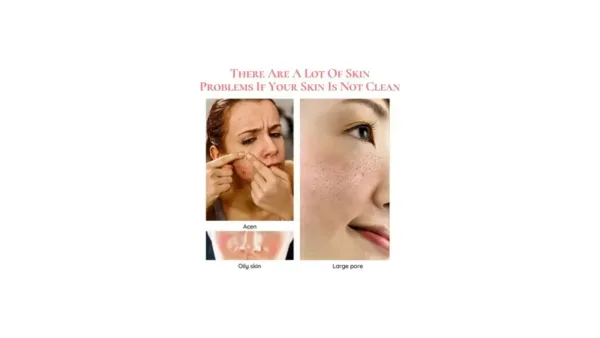 Removedor Rugas Rejuvenescimento Facial Radiofrequencia Anti - Imagem 3